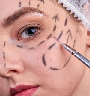 close-up-cosmetic-botox-injection-in-young-woman-f-2026-03-09-05-23-49-utc