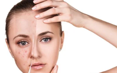 woman-receiving-lip-filler-treatment-at-medical-cl-2026-03-19-05-20-41-utc-768x512 (2)